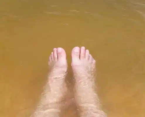 Wasser in den Beinen